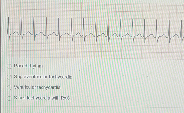 Solved: Paced rhythm Supraventricular tachycardia Ventricular ...