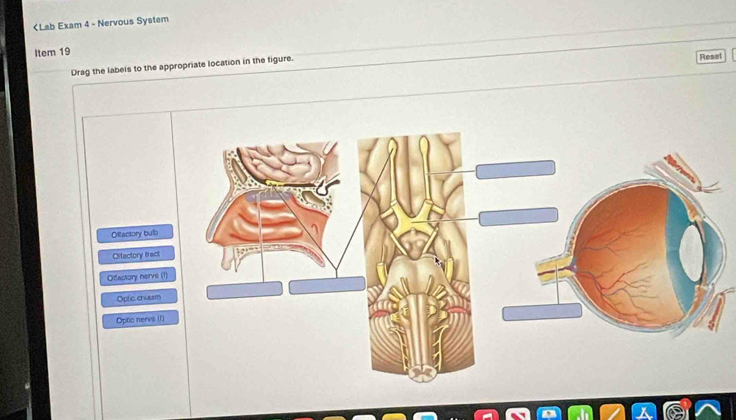 Offactory bulb
Offactory tract
Olfactory nerve (
Optic chiasm
Optic nervs (1)