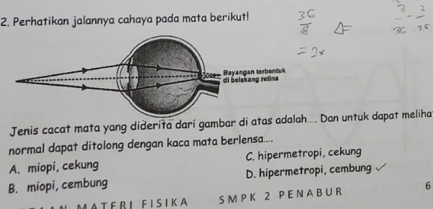 Perhatikan jalannya cahaya pada mata berikut!
Jenis cacat mata yang diderita dari gambar di atas ada.. Dan untuk dapat meliha
normal dapat ditolong dengan kaca mata berlensa....
A. miopi, cekung C. hipermetropi, cekung
B. miopi, cembung D. hipermetropi, cembung
6
MATERI FISIKA S M P K 2 P E N A B U R