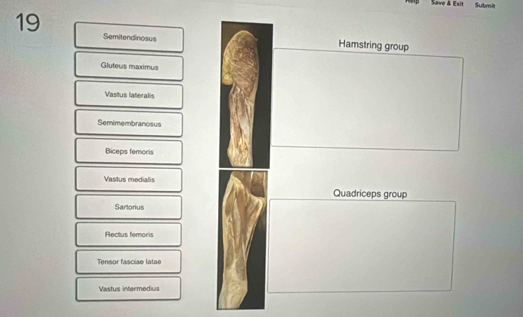 Save & Exit Submit 
19 
Semitendinosus Hamstring group 
Gluteus maximus 
Vastus lateralis 
Semimembranosus 
Biceps femoris 
Vastus medialis 
Quadriceps group 
Sartorius 
Rectus femoris 
Tensor fasciae latae 
Vastus intermedius