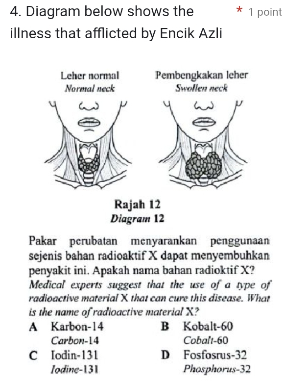 Diagram below shows the 1 point
illness that afflicted by Encik Azli
Pakar perubatan menyarankan penggunaan
sejenis bahan radioaktif X dapat menyembuhkan
penyakit ini. Apakah nama bahan radioktif X?
Medical experts suggest that the use of a type of
radioactive material X that can cure this disease. What
is the name of radioactive material X?
A Karbon- 14 B Kobalt- 60
Carbon- 14 Cobalt -60
C Iodin- 131 D Fosfosrus- 32
Iodine- 131 Phosphorus -32