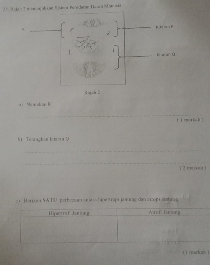 Rajah 2 menunjukkan Sistem Peredaran Darah Manusia 
a) Namakan R
_ 
( l markah ) 
b) Terangkan kitaran Q
_ 
_ 
( 2 markah ) 
c) Berikan SATU perbezaan antara hipertropi jantung dan atropi jantung. 
(1 markah )