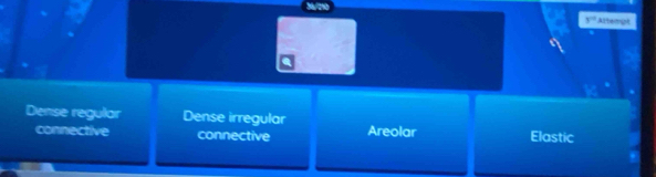 Albemgt
3°
Dense regular Dense irregular Elastic
connective connective Areolar