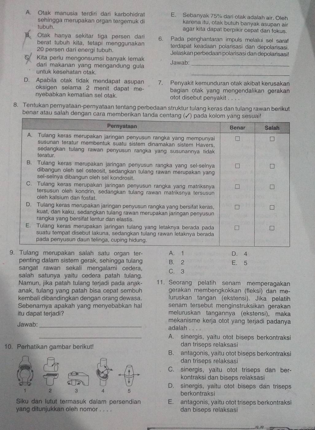 Otak manusia terdiri dari karbohidrat E. Sebanyak 75% dari otak adalah air. Oleh
sehingga merupakan organ tergemuk di karena itu, otak butuh banyak asupan air
tubuh. agar kita dapat berpikir cepat dan fokus.
B. Otak hanya sekitar tiga persen dari 6. Pada penghantaran impuls melalui sel saraf
berat tubuh kita, tetapi menggunakan terdapat keadaan polarisasi dan depolarisasi.
20 persen dari energi tubuh. Jelaskan perbedaan polarisasi dan depolarisasi!
Kita perlu mengonsumsi banyak lemak Jawab:
dari makanan yang mengandung gula_
_
untuk kesehatan otak.
D. Apabila otak tidak mendapat asupan 7. Penyakit kemunduran otak akibat kerusakan
oksigen selama 2 menit dapat me- bagian otak yang mengendalikan gerakan
nyebabkan kematian sel otak. otot disebut penyakit . . . .
8. Tentukan pernyataan-pernyataan tentang perbedaan struktur tulang keras dan tulang rawan berikut
benar atau salah dengan cara memberika
9. Tulang merupakan salah satu organ ter- A. 1 D. 4
penting dalam sistem gerak, sehingga tulang B. 2 E. 5
sangat rawan sekali mengalami cedera, C. 3
salah satunya yaitu cedera patah tulang.
Namun, jika patah tulang terjadi pada anak- 11. Seorang pelatih senam memperagakan
anak, tulang yang patah bisa cepat sembuh gerakan membengkokkan (fleksi) dan me-
kembali dibandingkan dengan orang dewasa. luruskan tangan (ekstensi). Jika pelatih
Sebenarnya apakah yang menyebabkan hal senam tersebut menginstruksikan gerakan 
itu dapat terjadi? meluruskan tangannya (ekstensi), maka
Jawab:_
mekanisme kerja otot yang terjadi padanya
adalah
_A. sinergis, yaitu otot biseps berkontraksi
10. Perhatikan gambar berikut!
dan triseps relaksasi
B. antagonis, yaitu otot biseps berkontraksi
dan triseps relaksasi
C. sinergis, yaitu otot triseps dan ber-
kontraksi dan biseps relaksasi
D. sinergis, yaitu otot biseps dan triseps
berkontraksi
Siku dan lutut termasuk dalam persendian E. antagonis, yaitu otot triseps berkontraksi
yang ditunjukkan oleh nomor . . . . dan biseps relaksasi