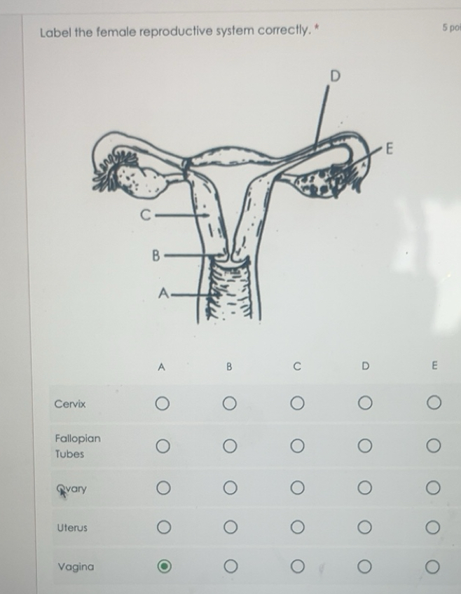 Solved: Label the female reproductive system correctly. * 5 po A B C D ...