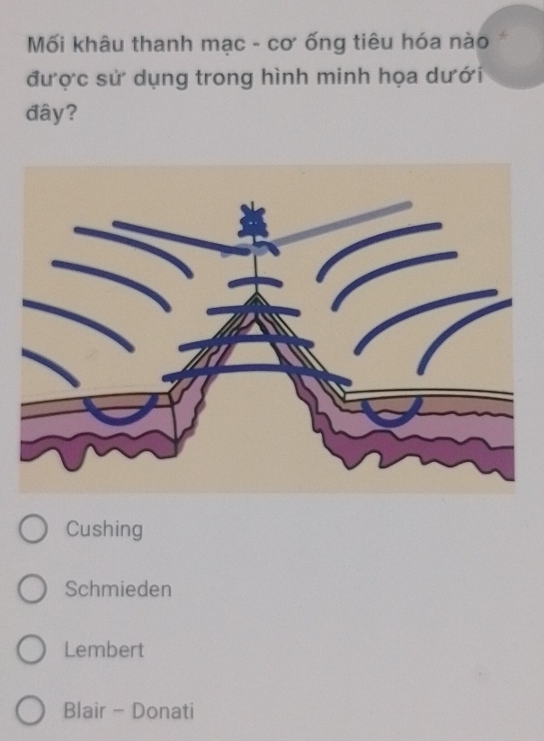 Mối khâu thanh mạc - cơ ống tiêu hóa nào
được sử dụng trong hình minh họa dưới
đây?
Cushing
Schmieden
Lembert
Blair - Donati