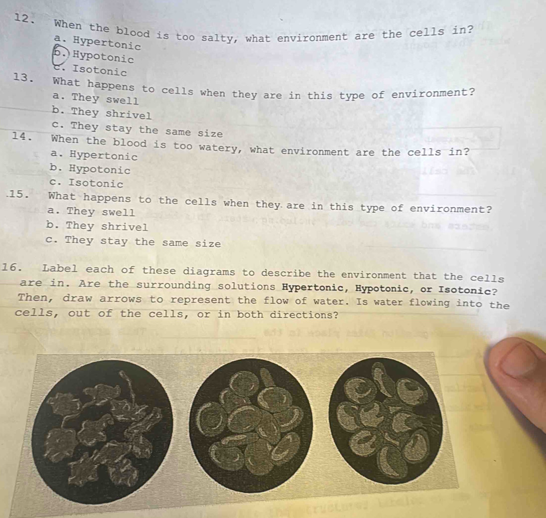 When the blood is too salty, what environment are the cells in?
a. Hypertonic
b.Hypotonic
c. Isotonic
13. What happens to cells when they are in this type of environment?
a. They swell
b. They shrivel
c. They stay the same size
14. When the blood is too watery, what environment are the cells in?
a. Hypertonic
b. Hypotonic
c. Isotonic
.15. What happens to the cells when they are in this type of environment?
a. They swell
b. They shrivel
c. They stay the same size
16. Label each of these diagrams to describe the environment that the cells
are in. Are the surrounding solutions Hypertonic, Hypotonic, or Isotonic?
Then, draw arrows to represent the flow of water. Is water flowing into the
cells, out of the cells, or in both directions?