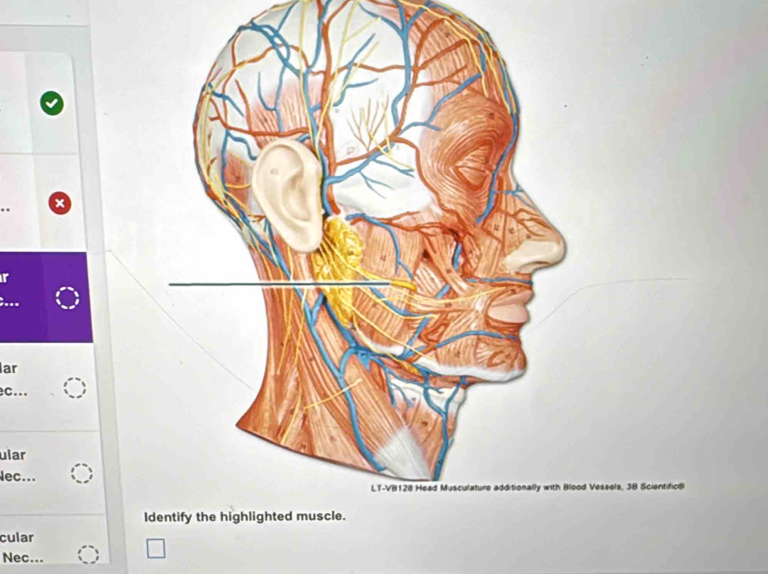 ar 
c... 
ular 
Nec... 
Vessels, 38 Scientific® 
I 
cular 
Nec...