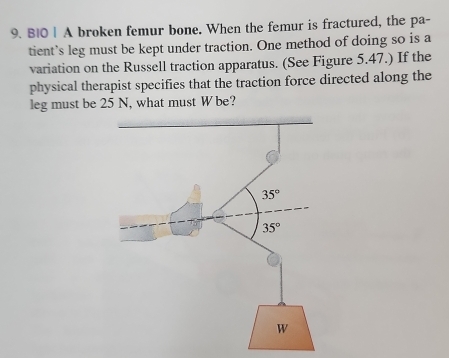 BI0 | A broken femur bone. When the femur is fractured, the pa-
tient’s leg must be kept under traction. One method of doing so is a
variation on the Russell traction apparatus. (See Figure 5.47.) If the
physical therapist specifies that the traction force directed along the
leg must be 25 N, what must W be?