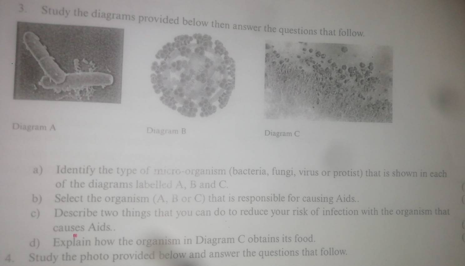 Study the diagrams provided below then answer the questions that follow. 
Diagram A Diagram B 
Diagram C 
a) Identify the type of micro-organism (bacteria, fungi, virus or protist) that is shown in each 
of the diagrams labelled A, B and C. 
b) Select the organism (A, B or C) that is responsible for causing Aids.. 
c) Describe two things that you can do to reduce your risk of infection with the organism that 
causes Aids.. 
d) Explain how the organism in Diagram C obtains its food. 
4. Study the photo provided below and answer the questions that follow.