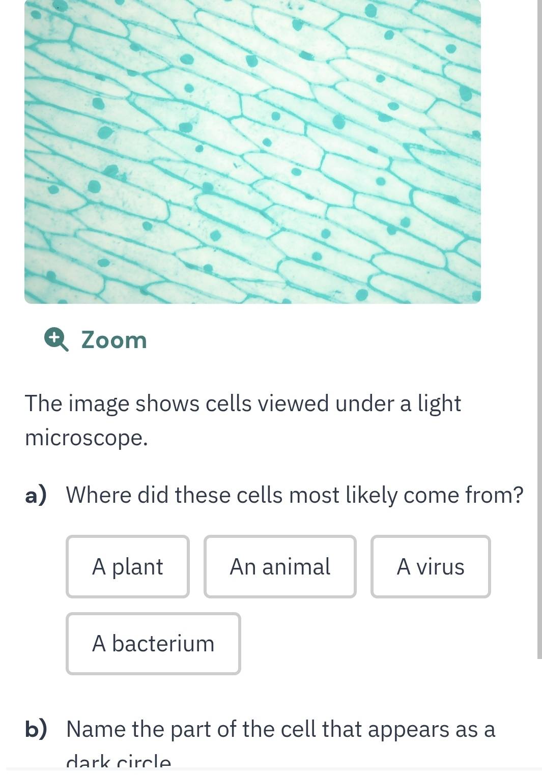 Solved: Zoom The image shows cells viewed under a light microscope. a ...