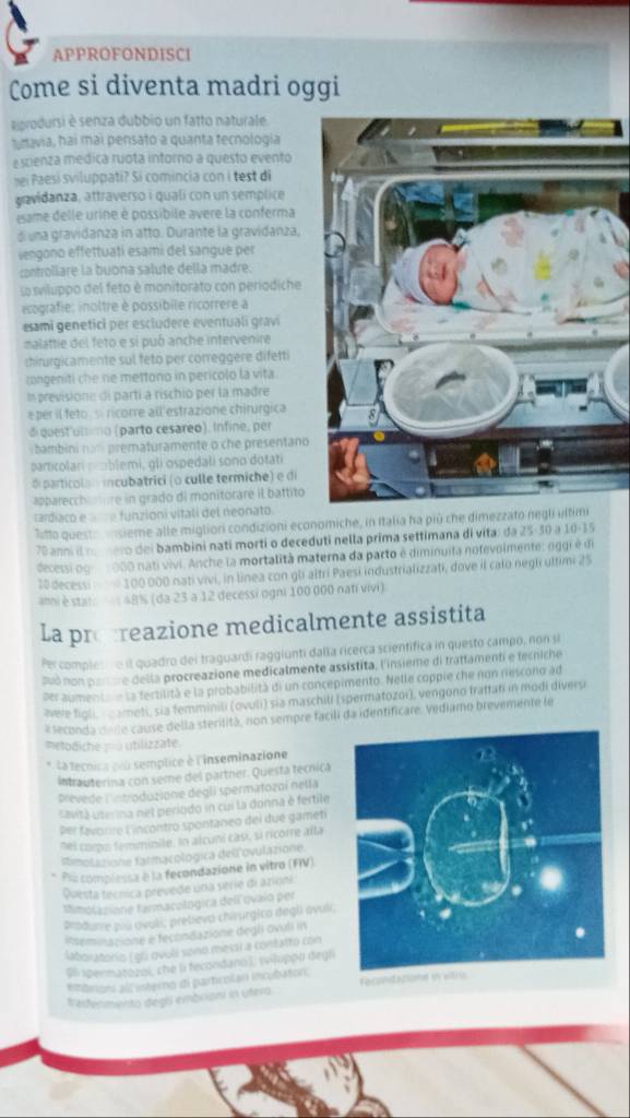 APPROFONDISCI
Come si diventa madri oggi
aprodursi è senza dubbio un fatto naturale.
taavia, hai mai pensato a quanta tecnologia
escienza medica ruota intorno a questo evento
hi Paesi sviluppati? Si comincia con i test di
gavidanza, attraverso i quali con un semplice
same delle urine é possibile avere la conferma
d una gravidanza in atto. Durante la gravidanza,
sengono effettuatí esami del sangue per
controllare la buona salute della madre.
so sviluppo del feto è monitorato con períodiche
ecografie: inoltre è possibile ricorrere a
eami genetici per escludere eventuali gravi
malattie del feto e sí puó anche intervenire
chirurgicamente sul feto per correggere difett
congeniti che ne mettono in pericolo la vita.
In previsióne di partí a rischio per la madre
e per il feto si ricorre all'estrazione chirurgica
di quest'umimo (parto cesáreo). Infine, per
bambini nan prematuramente o che presentano
particolan pmblemi, gli ospedali sono dotati
d particolan incubatrici (o culle termiche) e di
apparecchomure in grado di monitorare il battito
radiaco e r e funzioni vitali del neonato
Titto questo  nsieme alle migliori condizioni economiche, in Italia ha più che dimezzato n
70 anni il ma nero dei bambini nati morti o deceduti nella prima settimana di vita; da 25-30 a 10-15
decessi og 1000 nati vivi. Anche la mortalità materna da parto é diminuila nofevolmente: oggi é di
10 decessi 100 000 nati vivi, in linea con gli altri Paesi industrializzati, dove il calo negli ultimi 25
ahni èstat   48% (da 23 a 12 decessi ogni 100 000 nati vivi)
La pregreazione medicalmente assistita
Per comples e il quadro dei traguardi raggiunti dalla ricerca scientifica in questo campo, non si
Puó non parore della procreazione medicalmente assístita, l'insieme di trattamenti e fecniche
per aumentae la fertilità e la probabilità di un concepimento. Nelle coppie che non rescono ad
aele figli,  cameti, sia temminili (ovuli) sia maschili (spermatozoi), vengono traftati in modi diversi
2 seconda dete cause della sterilità, non sempre facili da identificare. Vediamo brevemente le
metodiche po utilizzate.
* la tecnica pll semplice à l'inseminazione
intrauterina con seme del partner. Querta tecnica
prevede lntroduzione degli spermatozoi nella
avitá userina nel periodo in cui la donna è fertile
Der favorire l'incontro spontaneo del due gameti
nel como femminile. In alcuni casi, si ricorre alla
Rtmolazione farmacologica del ovulazione.
Pia complessa à la fecondazione in vitro (FIV)
Questa tecnica prevede una serie di azioni
timolazione farmacológica delí ovaio per
Produre piú ovali; prebevo chirurgico degú avuli;
Rseminazione e fecondazione degli ovuli in
Aboratorio (gi ovulí sono messi a contatro con
Sl 1permatozoi, che li fecondano), wiluppo degli
*mbriors all interno di parbrolan incubator.
Redenmento degl embrioni in utera