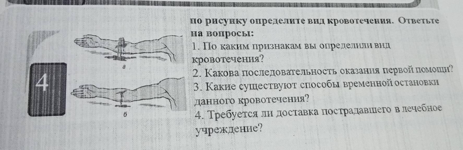 по рисунку опрелелите вил кровотечения. Ответьте 
а вопросы: 
. По каким ηризнакам вы определнлηηвид 
ровотечения? 
. Какова последовательность оказания первой πомошн? 
3. Какие сушествуюот способы временнойостановки 
данного кровотечения? 
4. Требуеτся лη досτавка постралавπего в лечебное 
учреждение?