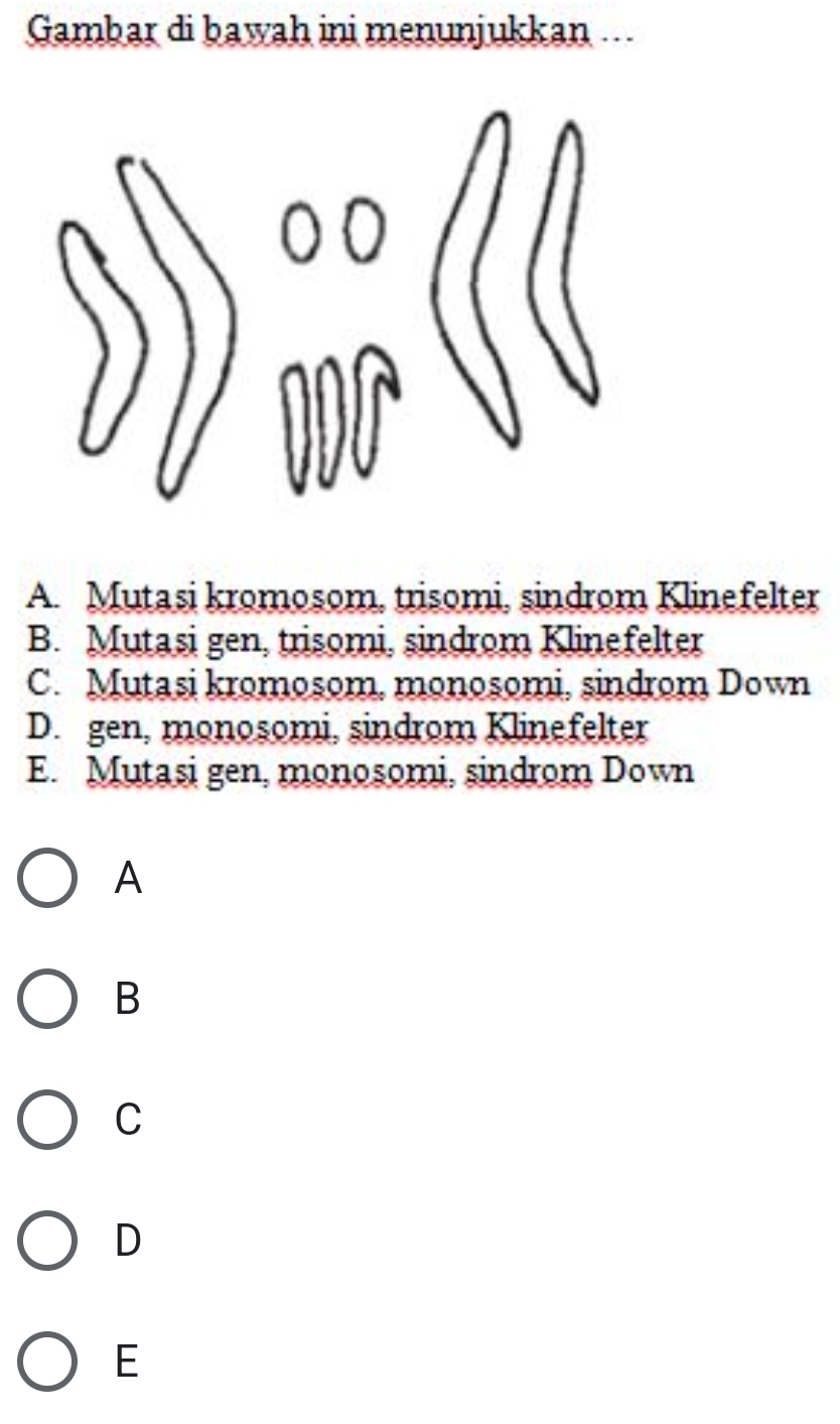 Gambar di bawah ini menunjukkan ..
A. Mutasi kromosom, trisomi, sindrom Klinefelter
B. Mutasi gen, trisomi, sindrom Klinefelter
C. Mutasi kromosom, monosomi, sindrom Down
D. gen, monosomi, sindrom Klinefelter
E. Mutasi gen, monosomi, sindrom Down
A
B
C
D
E