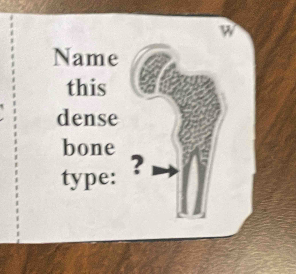 Name 
this 
dense 
bone 
type: 
?