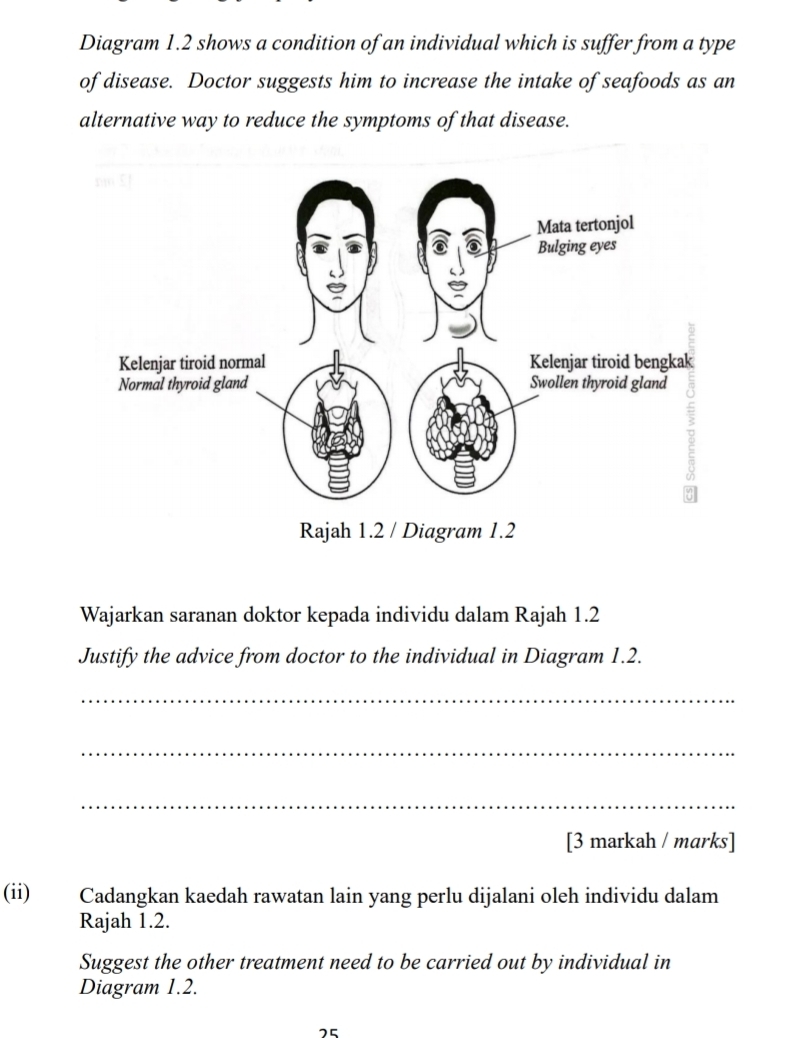 Diagram 1.2 shows a condition of an individual which is suffer from a type 
of disease. Doctor suggests him to increase the intake of seafoods as an 
alternative way to reduce the symptoms of that disease. 
Wajarkan saranan doktor kepada individu dalam Rajah 1.2 
Justify the advice from doctor to the individual in Diagram 1.2. 
_ 
_ 
_ 
[3 markah / marks] 
(ii) Cadangkan kaedah rawatan lain yang perlu dijalani oleh individu dalam 
Rajah 1.2. 
Suggest the other treatment need to be carried out by individual in 
Diagram 1.2. 
25