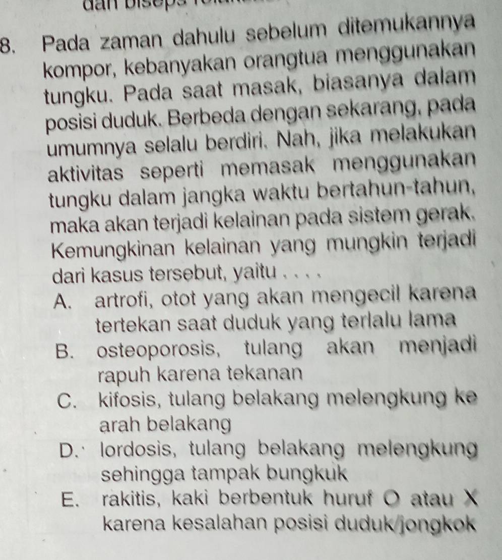 dan biseps
8. Pada zaman dahulu sebelum ditemukannya
kompor, kebanyakan orangtua menggunakan
tungku. Pada saat masak, biasanya dalam
posisi duduk. Berbeda dengan sekarang, pada
umumnya selalu berdiri. Nah, jika melakukan
aktivitas seperti memasak menggunakan
tungku dalam jangka waktu bertahun-tahun,
maka akan terjadi kelainan pada sistem gerak.
Kemungkinan kelainan yang mungkin terjadi
dari kasus tersebut, yaitu . . . .
A. artrofi, otot yang akan mengecil karena
tertekan saat duduk yang terlalu lama
B. osteoporosis, tulang akan menjadi
rapuh karena tekanan
C. kifosis, tulang belakang melengkung ke
arah belakang
D. lordosis, tulang belakang melengkung
sehingga tampak bungkuk
E. rakitis, kaki berbentuk huruf O atau X
karena kesalahan posisi duduk/jongkok