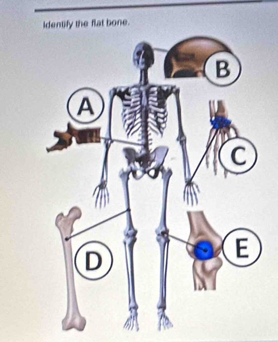 Identify the flat bone.