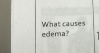 What causes 
edema?