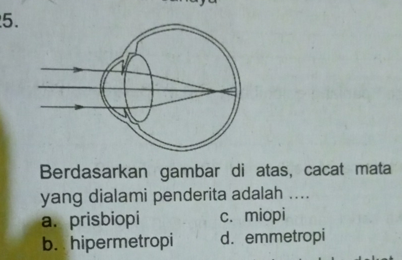 Berdasarkan gambar di atas, cacat mata
yang dialami penderita adalah ....
a. prisbiopi c. miopi
b. hipermetropi d. emmetropi