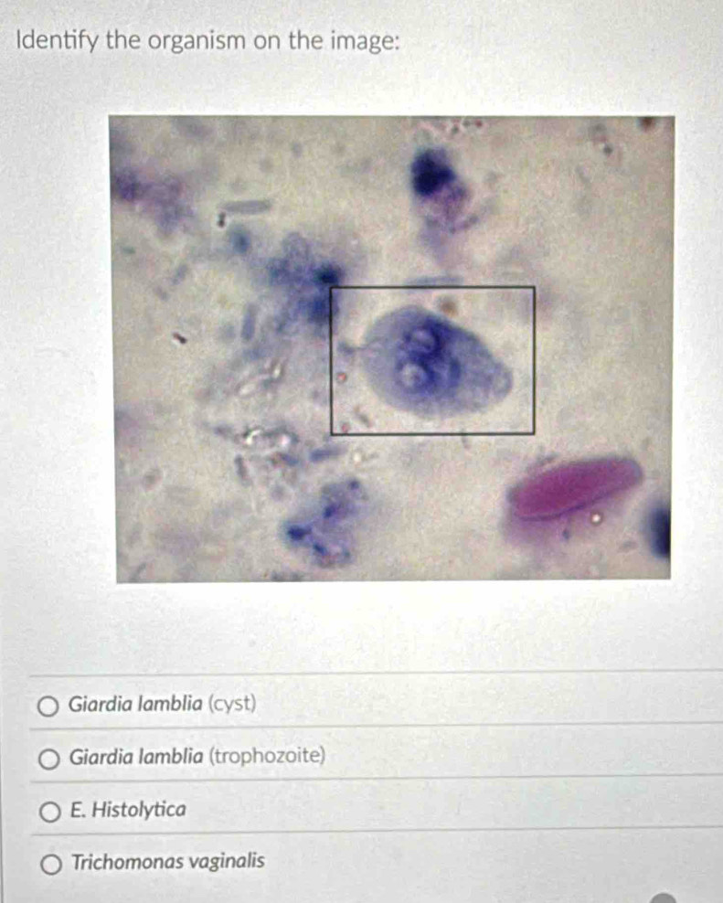 Identify the organism on the image:
Giardia lamblia (cyst)
Giardia lamblia (trophozoite)
E. Histolytica
Trichomonas vaginalis