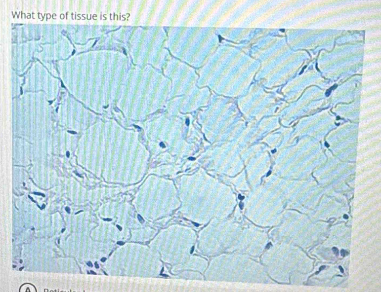 What type of tissue is