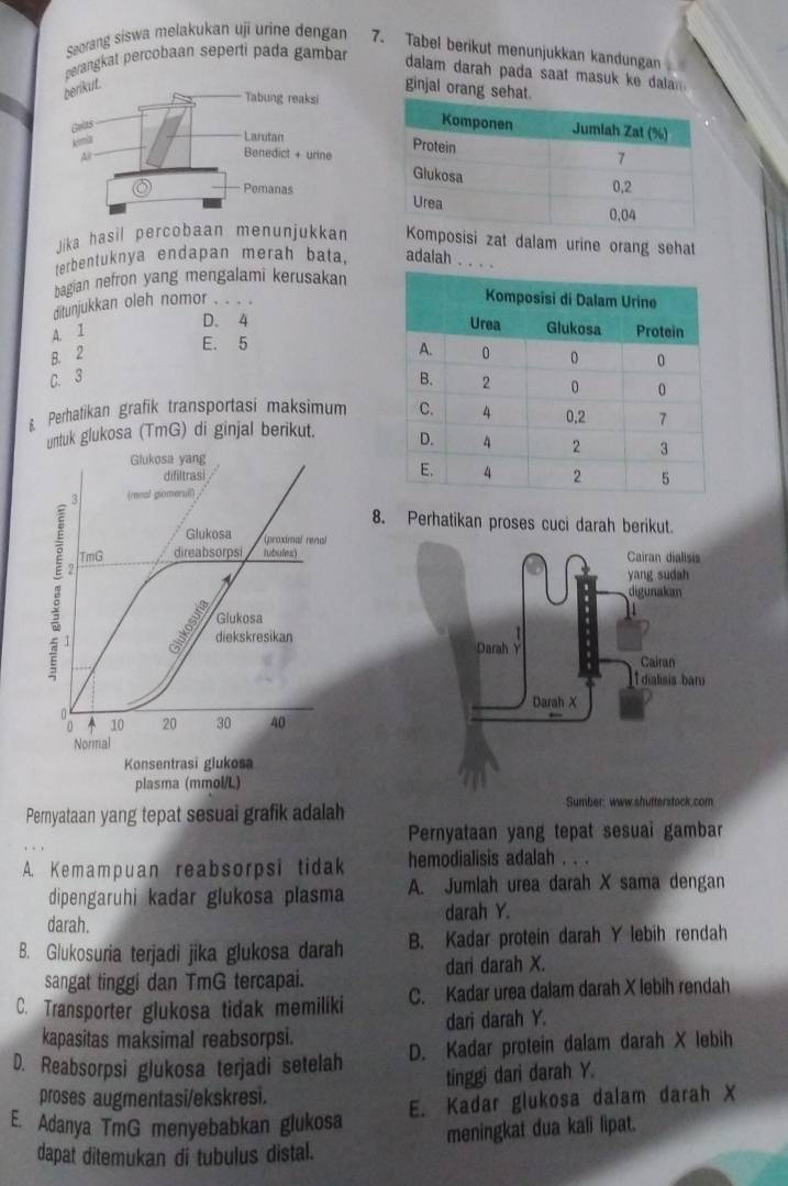 Seorang siswa melakukan ujī urine dengan 7. Tabel berikut menunjukkan kandungan
perangkat percobaan seperti pada gambar
dalam darah pada saat masuk ke dala .
ginjal orang sehat.
 
Jika hasil percobaan menunjukkansisi zat dalam urine orang sehat
terbentuknya endapan merah bata, adalah . . . .
bagian nefron yang mengalami kerusakan
ditunjukkan oleh nomor . . . .
D. 4
A. I
E. 5
B. 2
C. 3 
Perhatikan grafik transportasi maksimum
untuk glukosa (TmG) di ginjal berikut. 
Glukosa yang
difiltras 
3 (renal giomerull)
8. Perhatikan proses cuci darah berikut
Glukosa (proximal renal
TmG direabsorpsi lubules)
2
N
Glukosa
2 diekskresikan
^ 10 20 30 40
Normal
Konsentrasi glukosa
plasma (mmol/L)
Pernyataan yang tepat sesuai grafik adalah Sumber: www.shutterstock.com
Pernyataan yang tepat sesuai gambar
A. Kemampuan reabsorpsi tidak hemodialisis adalah . . .
dipengaruhi kadar glukosa plasma A. Jumlah urea darah X sama dengan
darah. darah Y.
B. Glukosuria terjadi jika glukosa darah B. Kadar protein darah Y lebih rendah
sangat tinggi dan TmG tercapai. dari darah X.
C. Transporter glukosa tidak memilíki C. Kadar urea dalam darah X lebih rendah
kapasitas maksimal reabsorpsi. dari darah Y.
D. Reabsorpsi glukosa terjadi setelah D. Kadar protein dalam darah X lebih
tinggi dari darah Y.
proses augmentasi/ekskresi.
E. Kadar glukosa dalam darah X
E. Adanya TmG menyebabkan glukosa
dapat ditemukan di tubulus distal. meningkat dua kali lipat.