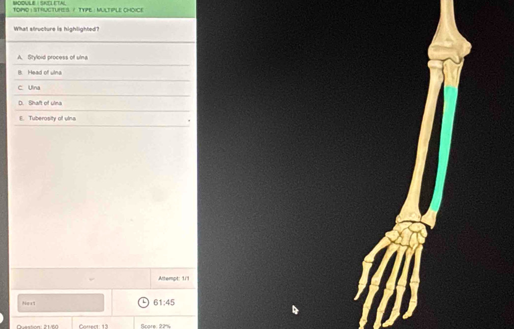 MODULE | SKELETAL
TOPIO : STRUCTURES / TYPE : MULTIPLE CHOICE
What structure is highlighted?
A. Styloid process of ulna
B. Head of ulna
C. Ulna
D. Shaft of ulna
E. Tuberosity of ulna
Attempt: 1/1
Next
L 61:45
Question 21 /60 Correct: 13 Score: 22%