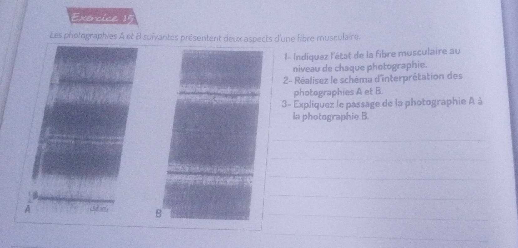 Les photographies A et B suivantes présentent deux aspects d'une fibre musculaire. 
1- Indiquez l'état de la fibre musculaire au 
niveau de chaque photographie. 
2- Réalisez le schéma d'interprétation des 
photographies A et B. 
3- Expliquez le passage de la photographie A à 
la photographie B. 
_ 
_ 
_ 
_ 
A 
_ 
_ 
_