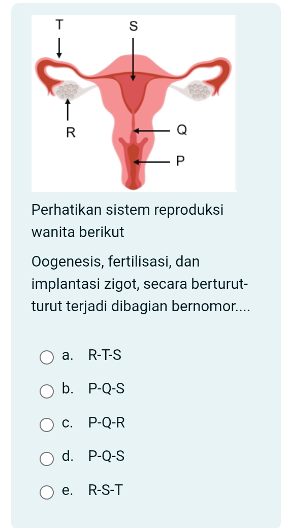 Perhatikan sistem reproduksi
wanita berikut
Oogenesis, fertilisasi, dan
implantasi zigot, secara berturut-
turut terjadi dibagian bernomor....
a. R-T-S
b. P-Q-S
c. P-Q-R
d. P-Q-S
e. R-S-T