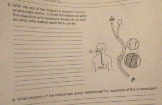 With the aid of the diagrams explain how the 
endoscope works. Include full deta is on what 
the objective and eyepiece lenses do as well 
_ 
as what information each fibre cames. 
_ 
_ 
_ 
_ 
_ 
_ 
_ 
_ 
_ 
_ 
_ 
_ 
_ 
_ 
4. What property of the endoscope design determines the resolution of the endoscope? 
_