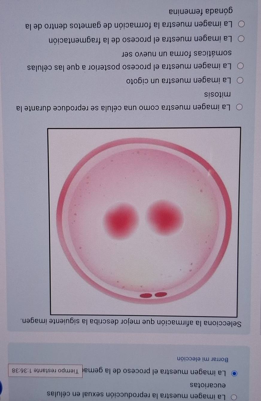 La imagen muestra la reproducción sexual en células
eucariotas
La imagen muestra el proceso de la gemaç Tiempo restante 1:36:38
Borrar mi elección
Selecciona la afirmación que mejoagen.
La imagen muestra como una célula se reproduce durante la
mitosis
La imagen muestra un cigoto
La imagen muestra el proceso posterior a que las células
somáticas forma un nuevo ser
La imagen muestra el proceso de la fragmentación
La imagen muestra la formación de gametos dentro de la
gónada femenina