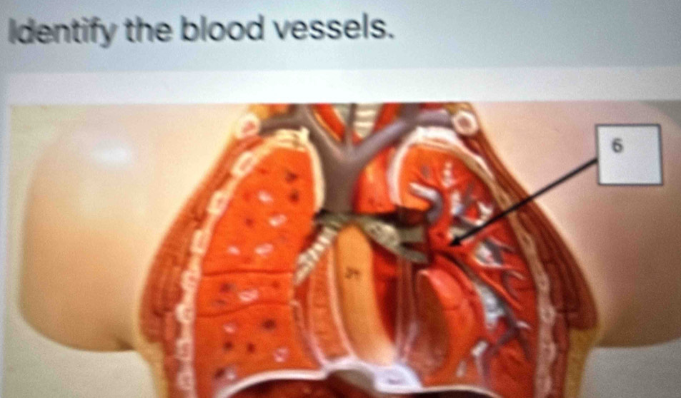 Identify the blood vessels.