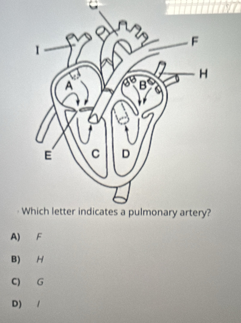 W
A) F
B) H
C) G
D) /