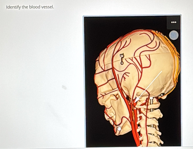 Identify the blood vessel.