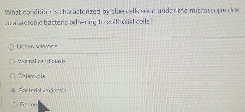 What condition is characterized by clue cells seen under the microscope due
to anaerobic bacteria adhering to epithelial cells?
Lichen sclerosis
Vaginal candidiasis
Chlamydia
Bacterial vaginosis
Gonor