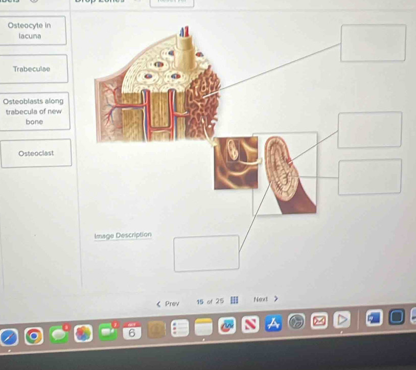 Osteocyte in 
lacuna 
Trabeculae 
Osteoblasts along 
trabecula of new 
bone 
Osteoclast 
Image Description 
Prev 15 of 25 Next