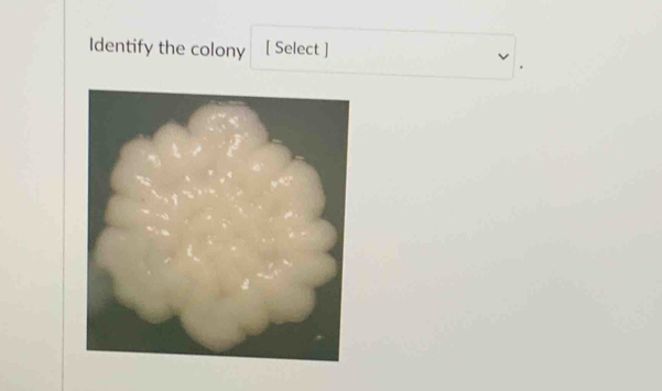 Identify the colony [ Select ]