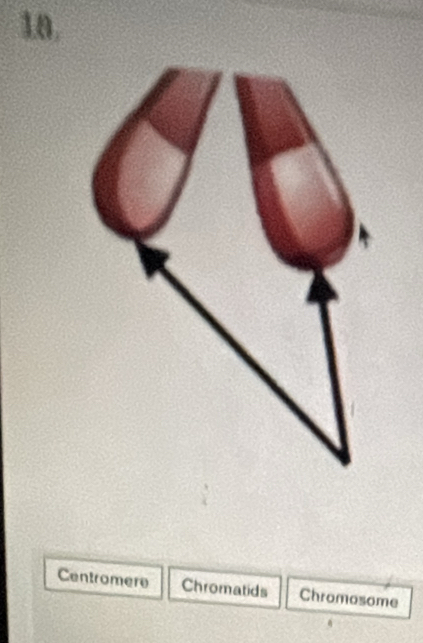 18, 
Centromere Chromatids Chromosome