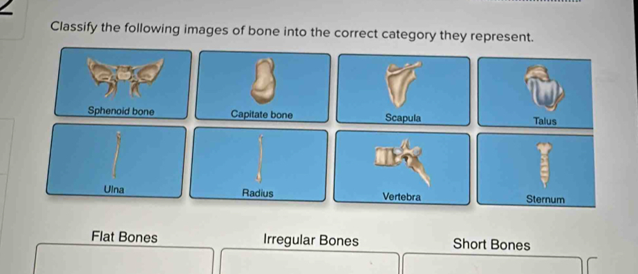 Classify the following images of bone into the correct category they represent.
Flat Bones Irregular Bones Short Bones