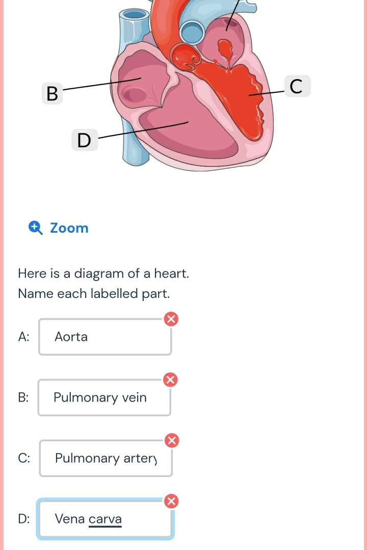 Zoom
Here is a diagram of a heart.
Name each labelled part.
A: Aorta
B: Pulmonary vein
C: Pulmonary arter)
×
D: Vena carva