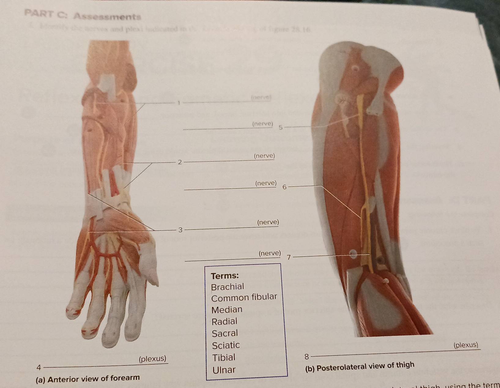 Assessments 
bortily the nerves and plexi indicated in the e d v m . of ligure 28.16 
1 
(nerve) 
(nerve) 5
(nerve) 
2 
(nerve) 6
(nerve) 
3 
(nerve) 7
Terms: 
Brachial 
Common fibular 
Median 
Radial 
Sacral 
Sciatic(plexus) 
(plexus) Tibial 
8 
4 
Ulnar 
(a) Anterior view of forearm (b) Posterolateral view of thigh 
g th e term