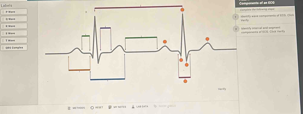 Solved: Components of an ECG Labels ete the following steps: P Wave ify ...