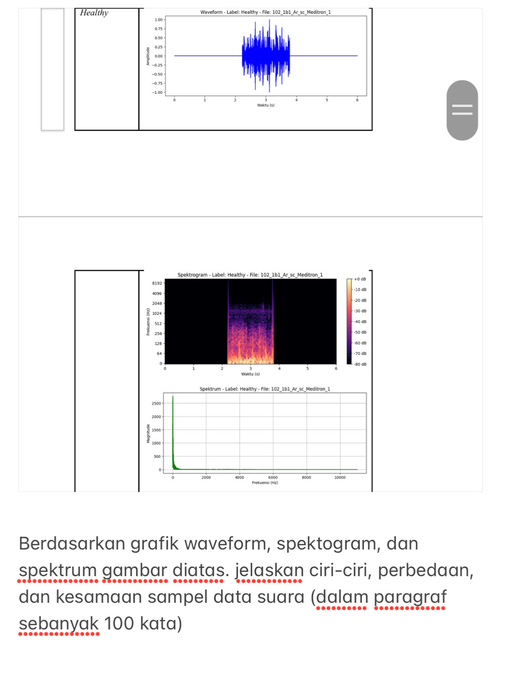 Healthy 
Berdasarkan grafik waveform, spektogram, dan 
spektrum gambar diatas. jelaskan ciri-ciri, perbedaan, 
dan kesamaan sampel data suara (dalam paragraf 
sebanyak 100 kata)