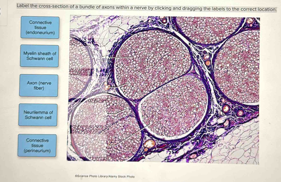 Solved: Label the cross-section of a bundle of axons within a nerve by ...