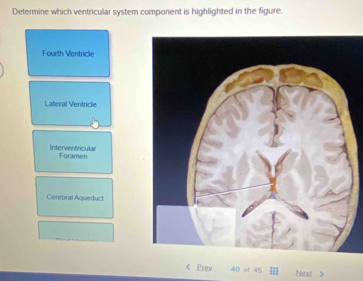Solved: Determine which ventricular system component is highlighted in ...