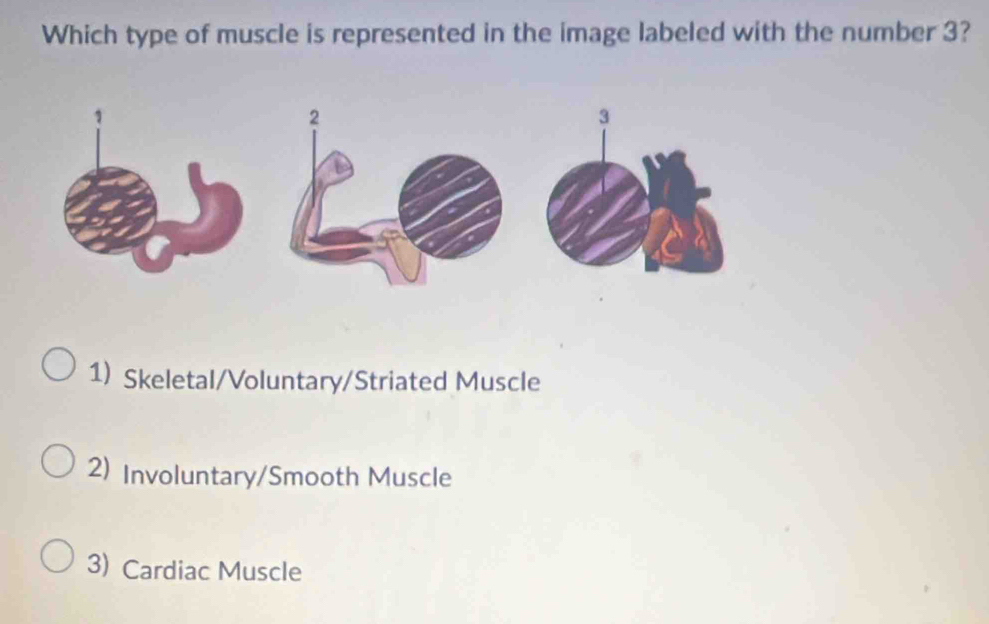 Solved: Which type of muscle is represented in the image labeled with ...