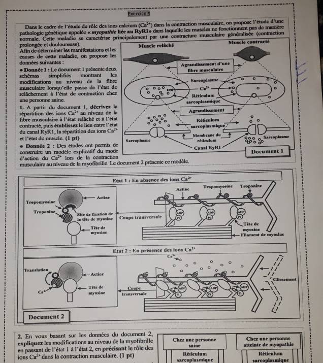 Dans le cadre de l'étude du rôle des ions calcium (Ca^(2+)) dans la contraction museulaire, on propose l'étude d'une
pathologie génétique appelée « myopathie liée au RyR1» dans laquelle les museles ne fonctionnent pas de manière
normale. Cette maladie se caractérise principalement par une contracture musculaire généralisée (contraction
prolongée et douloureuse). 
Afin de déterminer les manifestations et l
causes de cette maladie, on propose l
données suivantes :
* Donnée 1 : Le document 1 présente de
schémas simplifiés montrant l
modifications au niveau de la fib
musculaire lorsqu'elle passe de l'état 
relâchement à l'état de contraction ch
une personne saine.
1. A partir du document I, décrivez
répartition des ions Ca^(2+) au niveau de
fibre musculaire à l'état relâché et à l'é
contracté, puis établissez le lien entre l'é
du canal RyR1, la répartition des ions Ca^(2+)
et l'état du muscle. (1 pt) 
Donnée 2 : Des études ont permis 
construire un modèle explicatif du mo
d'action du Ca^(2+) ors de la contract
musculaire au niveau de la myofibrille. 
Etat 1 : En absence des ions Ca^(2+)
Actine Tropomyosine Troponine
Trepomyosiac Actine
Tropanine  Site de fixation de
ls tête de myusine Coupe transversale
Tête de
myosine Tête de
myosine
Filament de myosine
Etat 2 : En présence des ions Ca^(2+)
C
Translation
Actine
Tête de
C_n myosine Coupe
trunsversale^(Document 2
2. En vous basant sur les données du document 2,
expliquez les modifications au niveau de la myofibrille Chez une personne saine atteinte de myopathie Chez une personne
en passant de l'état 1 à l'état 2, en précisant le rôle des
ions Ca^2+) dans la contraction musculaire. (1 pt) sarcoplasmique Réticulum sarcoplasmique Réticulum