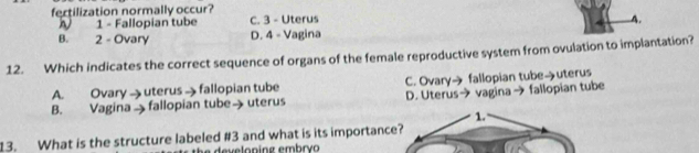 fectilization normally occur?
1 - Fallopian tube C. 3 - Uterus A.
B. 2 - Ovary D. 4 - Vagina
12. Which indicates the correct sequence of organs of the female reproductive system from ovulation to implantation?
A. Ovary→uterus →fallopian tube C. Ovary→ fallopian tube→uterus
B. Vagina fallopian tube→ uterus D. Uterus→ vagina → fallopian tube
1.
13. What is the structure labeled # 3 and what is its importance?