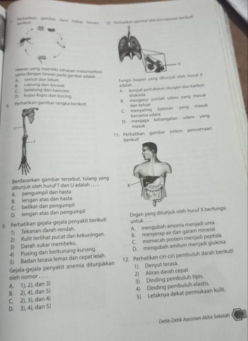 perikut erhatikan gambar deur hidup hawan 10. Perhatikan gambar alat perapasan berikut
Hewan yang memiliki tahapan metamorfosis
cama dengan hewan pada gambar adalah . . . .
A. semut dan lebah
Fungsi bagian yang ditunjuk oleruf X
8 capung dan kecoak adalah . . . .
belalang dan hamster
A. tempat pertukaran oksigen dan karbon
D. kupu-kupu dan kucing
dioksida
Perhatikan gambar rangka berikut!
B. mengatur jumlah udara yang masuk
dan keluar
C. menyaring kotoran yang masuk
bersama udara
D. menjaga kehangatan udara yang
U masuk
11. Perhatikan gambar sistem pencernaan

ut!
Berdasarkan gambar tersebut, tulang yang
ditunjuk oleh huruf T dan U adalah . . . .
A. pengumpil dan hasta
B. lengan atas dan hasta
C. belikat dan pengumpil
D. lengan atas dan pengumpil
9. Perhatikan gejala-gejala penyakit berikut! Organ yang ditunjuk oleh huruf X berfungsi
untuk . . . .
1) Tekanan darah rendah.
2) Kulit terlihat pucat dan kekuningan. A. mengubah amonia menjadi urea
3) Darah sukar membeku. B. menyerap air dan garam mineral
C. memecah protein menjadi peptida
D. mengubah amilum menjadi glukosa
4) Pusing dan berkunang-kunang.
5) Badan terasa lemas dan cepat lelah.
Gejala-gejala penyakit anemia ditunjukkan 12. Perhatikan ciri-ciri pembuluh darah berikut!
1) Denyut terasa.
oleh nomor . . . .
A. 1), 2), dan 3) 2) Aliran darah cepat.
3) Dinding pembuluh tipis.
C. 2), 3), dan 4) 4) Dinding pembuluh elastis.
B. 2), 4), dan 5)
D. 3), 4), dan 5) 5) Letaknya dekat permukaan kulit.
Detik-Detik Asesmen Akhir Sekolah 79